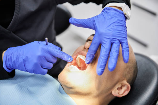 Best Broken Tooth Emergency  in Stansberry Lake, WA